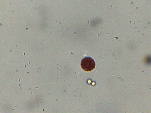 Haematococcus pluvialis e philodina